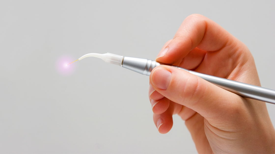 Dental laser treatment
